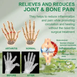 New Zealand Bee Venom Joint and Bone Therapy Advanced Cream