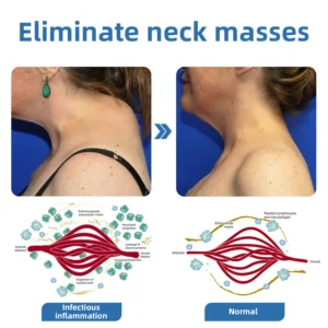 𝐌𝐫𝐞𝐒𝐢𝐨™ 𝗣𝗼𝗿𝘁𝗮𝗯𝗹𝗲 𝗟𝘆𝗺𝗽𝗵𝗮𝘁𝗶𝗰 𝗦𝗼𝗼𝘁𝗵𝗶𝗻𝗴 𝗕𝗼𝗱𝘆 𝗦𝗵𝗮𝗽𝗶𝗻𝗴 𝗨𝗹𝘁𝗿𝗮𝘀𝗼𝘂𝗻𝗱 𝗜𝗻𝘀𝘁𝗿𝘂𝗺𝗲𝗻𝘁 𝗳𝗼𝗿 𝗡𝗲𝗰𝗸