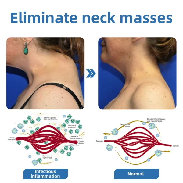 𝐌𝐫𝐞𝐒𝐢𝐨™ 𝗣𝗼𝗿𝘁𝗮𝗯𝗹𝗲 𝗟𝘆𝗺𝗽𝗵𝗮𝘁𝗶𝗰 𝗦𝗼𝗼𝘁𝗵𝗶𝗻𝗴 𝗕𝗼𝗱𝘆 𝗦𝗵𝗮𝗽𝗶𝗻𝗴 𝗨𝗹𝘁𝗿𝗮𝘀𝗼𝘂𝗻𝗱 𝗜𝗻𝘀𝘁𝗿𝘂𝗺𝗲𝗻𝘁 𝗳𝗼𝗿 𝗡𝗲𝗰𝗸
