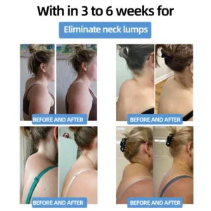 𝐌𝐫𝐞𝐒𝐢𝐨™ 𝗣𝗼𝗿𝘁𝗮𝗯𝗹𝗲 𝗟𝘆𝗺𝗽𝗵𝗮𝘁𝗶𝗰 𝗦𝗼𝗼𝘁𝗵𝗶𝗻𝗴 𝗕𝗼𝗱𝘆 𝗦𝗵𝗮𝗽𝗶𝗻𝗴 𝗨𝗹𝘁𝗿𝗮𝘀𝗼𝘂𝗻𝗱 𝗜𝗻𝘀𝘁𝗿𝘂𝗺𝗲𝗻𝘁 𝗳𝗼𝗿 𝗡𝗲𝗰𝗸