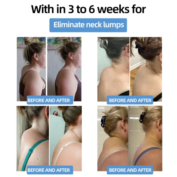 𝐌𝐫𝐞𝐒𝐢𝐨™ 𝗣𝗼𝗿𝘁𝗮𝗯𝗹𝗲 𝗟𝘆𝗺𝗽𝗵𝗮𝘁𝗶𝗰 𝗦𝗼𝗼𝘁𝗵𝗶𝗻𝗴 𝗕𝗼𝗱𝘆 𝗦𝗵𝗮𝗽𝗶𝗻𝗴 𝗨𝗹𝘁𝗿𝗮𝘀𝗼𝘂𝗻𝗱 𝗜𝗻𝘀𝘁𝗿𝘂𝗺𝗲𝗻𝘁 𝗳𝗼𝗿 𝗡𝗲𝗰𝗸