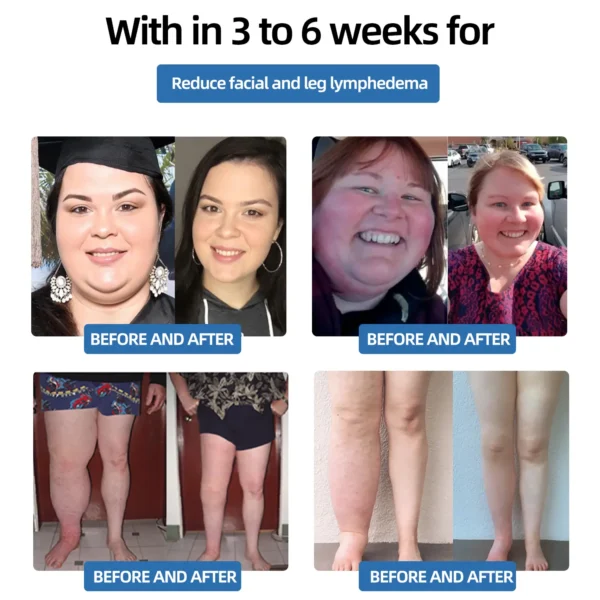 𝐌𝐫𝐞𝐒𝐢𝐨™ 𝗣𝗼𝗿𝘁𝗮𝗯𝗹𝗲 𝗟𝘆𝗺𝗽𝗵𝗮𝘁𝗶𝗰 𝗦𝗼𝗼𝘁𝗵𝗶𝗻𝗴 𝗕𝗼𝗱𝘆 𝗦𝗵𝗮𝗽𝗶𝗻𝗴 𝗨𝗹𝘁𝗿𝗮𝘀𝗼𝘂𝗻𝗱 𝗜𝗻𝘀𝘁𝗿𝘂𝗺𝗲𝗻𝘁 𝗳𝗼𝗿 𝗡𝗲𝗰𝗸