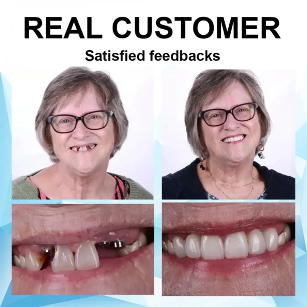 𝗦𝗺𝗶𝗹𝗲𝗵𝗽𝘆™𝐒𝐢𝐥𝐢𝐜𝐨𝐧𝐞 𝐑𝐞𝐥𝐢𝐧𝐞 𝐃𝐞𝐧𝐭𝐮𝐫𝐞 𝐒𝐞𝐭