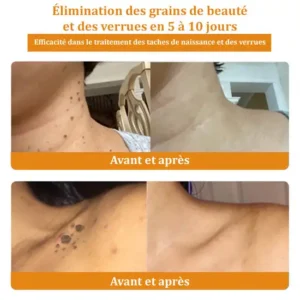 𝑇𝑢𝑟𝑜𝑛𝑢™ 𝐂𝐫è𝐦𝐞 𝐝𝐞 𝐭𝐫𝐚𝐢𝐭𝐞𝐦𝐞𝐧𝐭 𝐜𝐮𝐭𝐚𝐧é 𝐚𝐮 𝐯𝐞𝐧𝐢𝐧 𝐝'𝐚𝐛𝐞𝐢𝐥𝐥𝐞
