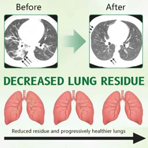 AAFQ® 𝐀𝐝𝐯𝐚𝐧𝐜𝐞𝐝 𝐋𝐮𝐧𝐠 𝐂𝐥𝐞𝐚𝐧𝐬𝐢𝐧𝐠 𝐒𝐩𝐫𝐚𝐲