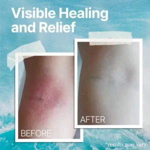 AEXZR™ Ocean Healed Eczema Soothing Cream