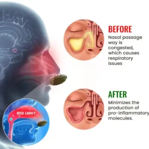 AEXZR™ Respiratory Relief Light Therapy