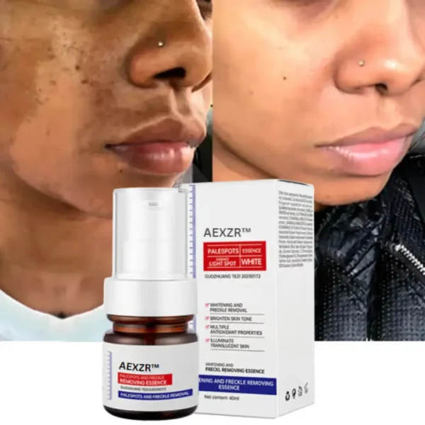 AEXZR™ Vitamin C Whitening Freckles Face Cream Remove Melasma Dark Spots Lighten Melanin