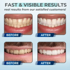 AEXZR™ Whitening Mousse Toothpaste
