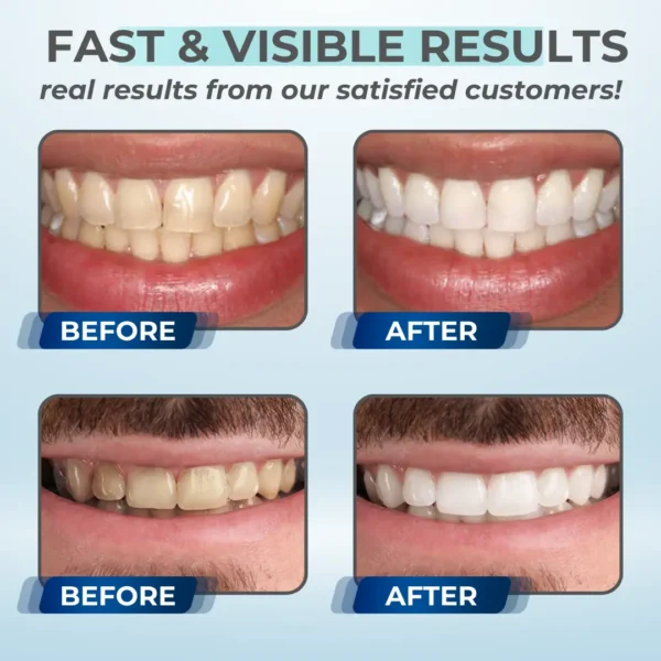 AEXZR™ Whitening Mousse Toothpaste