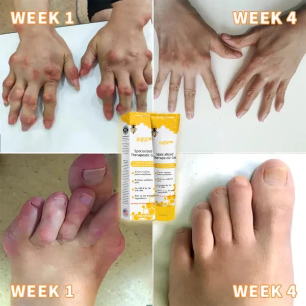 AQA™ Joint Therapy Pain Relief Gel