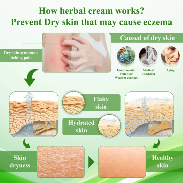 AQA™ Resurrection Grass Skin Soothing Herbal Cream