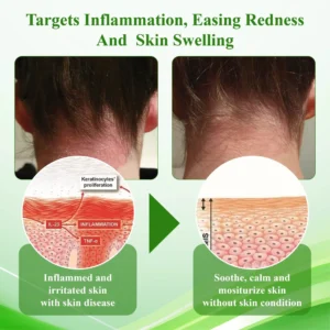AQA™ Resurrection Grass Skin Soothing Herbal Cream