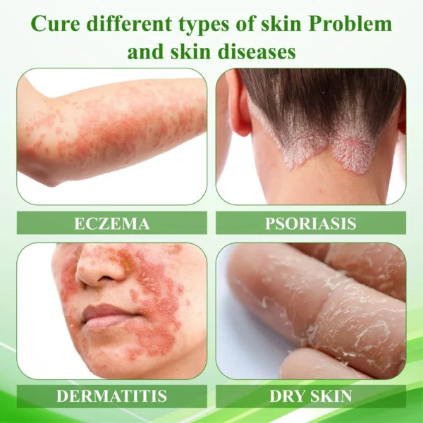 AQA™ Resurrection Grass Skin Soothing Herbal Cream