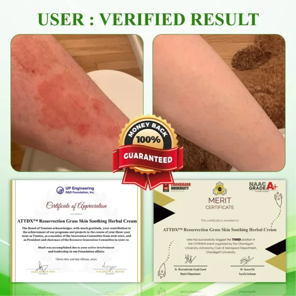 AQA™ Resurrection Grass Skin Soothing Herbal Cream