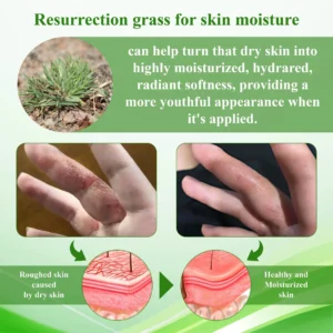 AQA™ Resurrection Grass Skin Soothing Herbal Cream