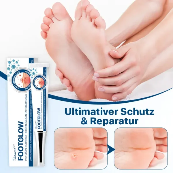 Biancat™ FußGlow Pro-Stärke Hornhaut- und Schwielenentferner-Gel