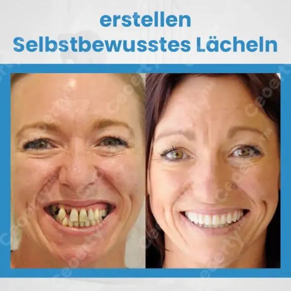 Ceoerty™ ComFit Silikon-Prothesenset