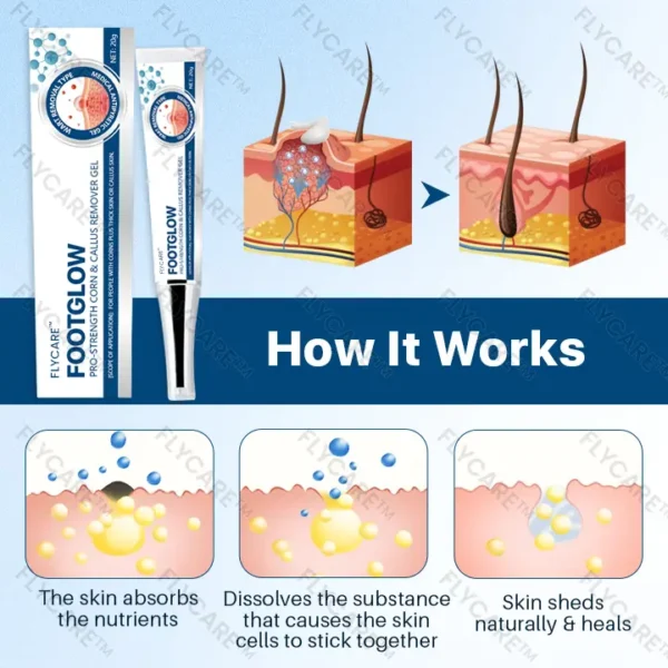 FLYCARE™ FootGlow Pro-Strength Corn & Callus Remover Gel