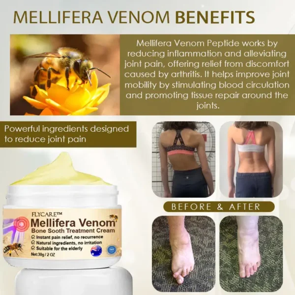 FLYCARE™ Mellifera Venom BoneSooth DX Treatment Cream