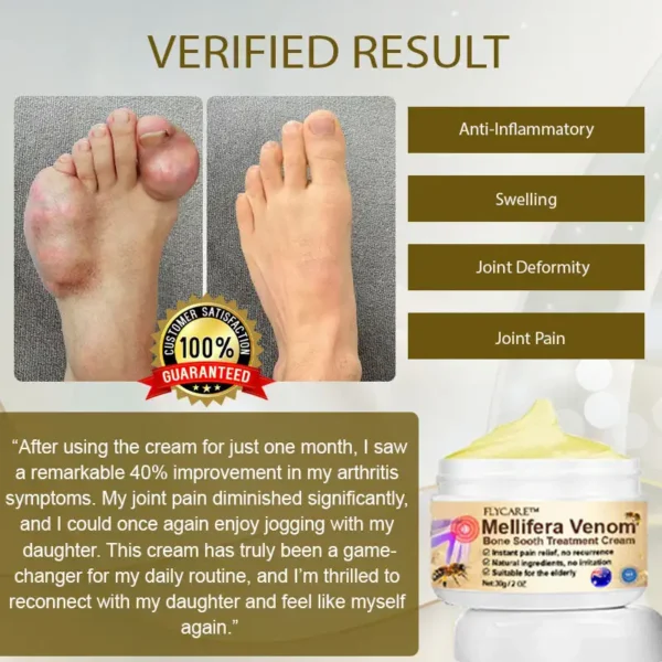 FLYCARE™ Mellifera Venom BoneSooth DX Treatment Cream