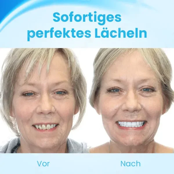 Fivfivgo™ FlexYoSmile Silikon-Prothesen-Set