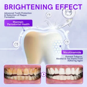 Furzero™ V34 Purple Teeth Whitening Toothpaste