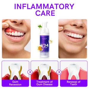 Furzero™ V34 Purple Teeth Whitening Toothpaste