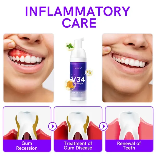 Furzero™ V34 Purple Teeth Whitening Toothpaste
