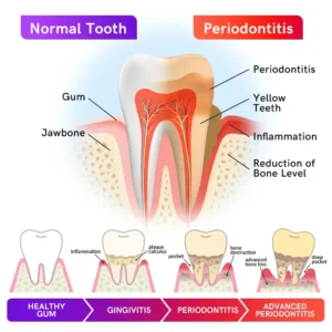 Furzero™ V34 Purple Teeth Whitening Toothpaste