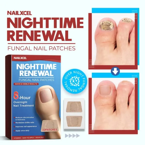 NailXcel Nighttime Renewal Fungal Nail Patches