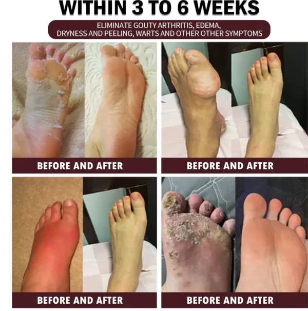 30-Herb Slimming & Detox Foot Bath Medicinal Drops