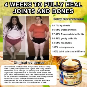 Aetheris™ Bee-Venom Pain-Relief Bone Healing Cream