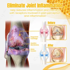 Ceoerty™ BuzzCure Bee Venom Joint & Bone Therapy Cream