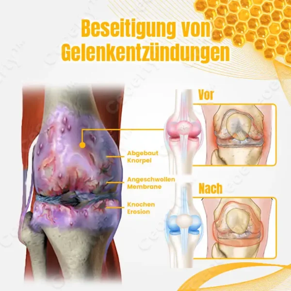 Ceoerty™ BuzzCure Bienengift Gelenk- und Knochentherapie Creme