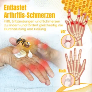 Ceoerty™ BuzzCure Bienengift Gelenk- und Knochentherapie Creme
