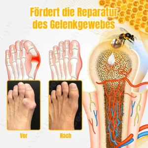 Ceoerty™ BuzzCure Bienengift Gelenk- und Knochentherapie Creme
