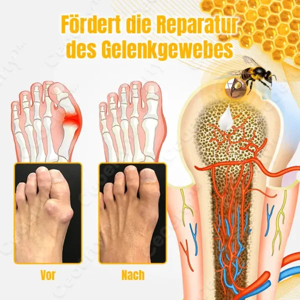 Ceoerty™ BuzzCure Bienengift Gelenk- und Knochentherapie Creme