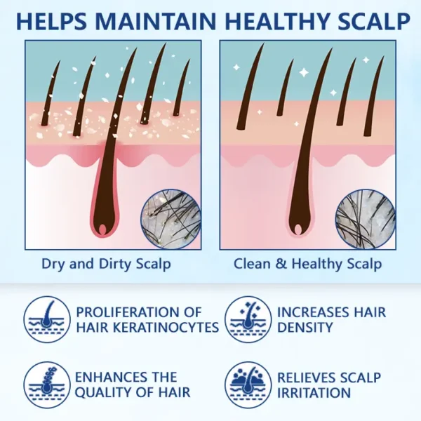 Ceoerty™ RevitaRoot Hair Regrowth Cream