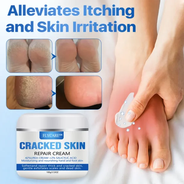 FLYCARE™ Cracked Skin Repair Cream