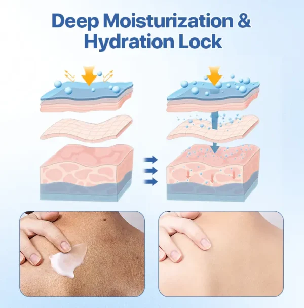 FLYCARE™ FrostCure Winter Cracked Skin Healing Cream