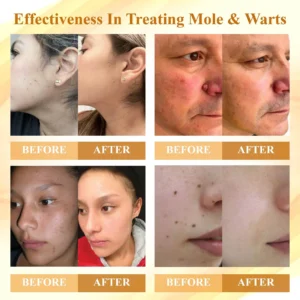 FLYCARE™ Mellifera Venom Skin Repairing Cream