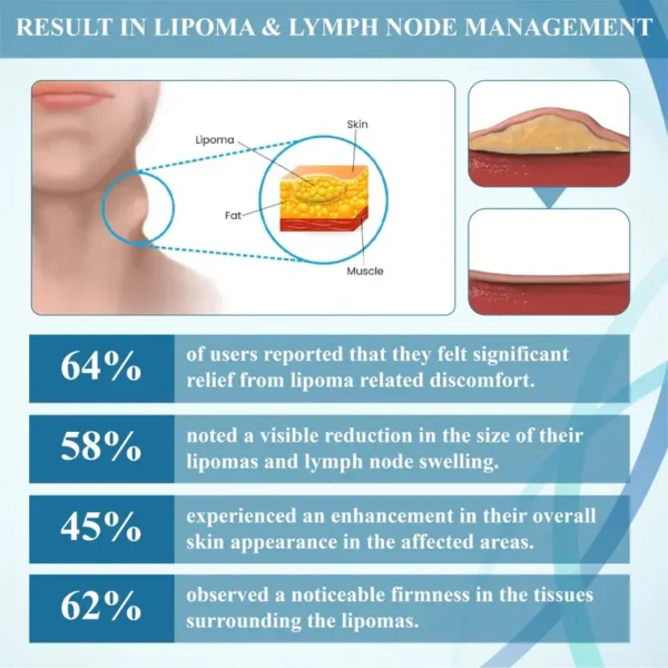 Fivfivgo™ LumpsClear Lymphstütze Roll-On