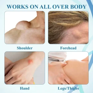 Fivfivgo™ LumpsClear Lymphstütze Roll-On