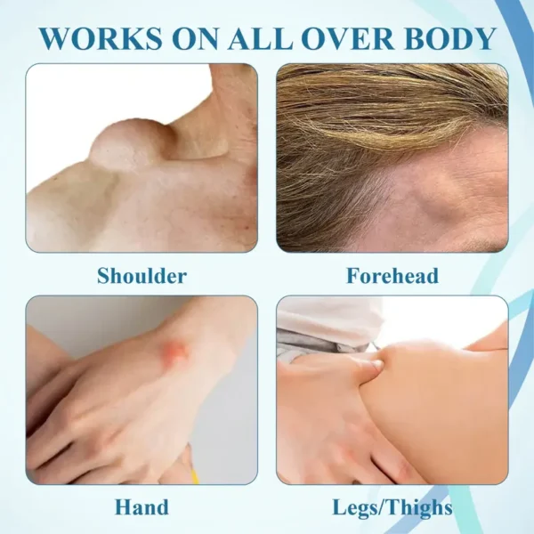 Fivfivgo™ LumpsClear Lymphstütze Roll-On