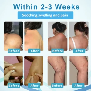 Fivfivgo™ LumpsClear Lymphstütze Roll-On