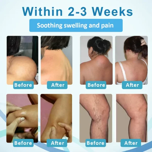 Fivfivgo™ LumpsClear Lymphstütze Roll-On