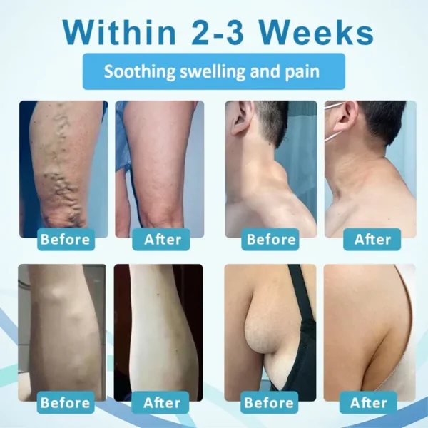 Fivfivgo™ LumpsClear Lymphstütze Roll-On