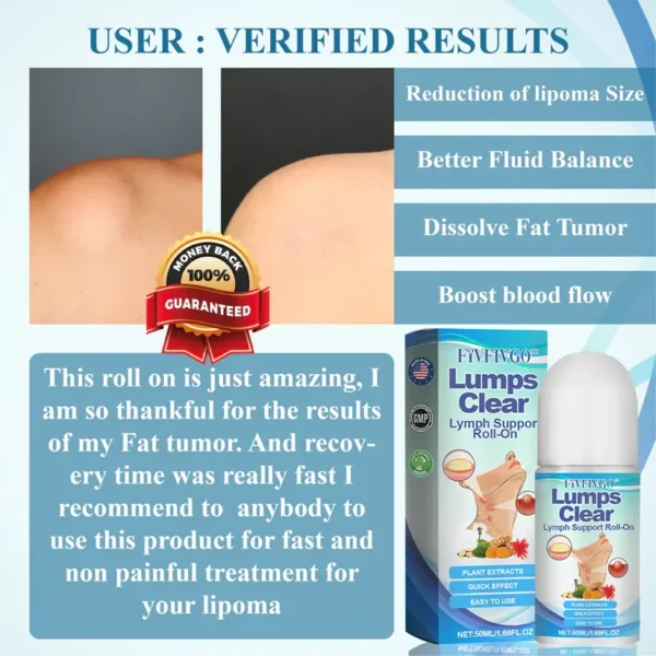 Fivfivgo™ LumpsClear Lymphstütze Roll-On