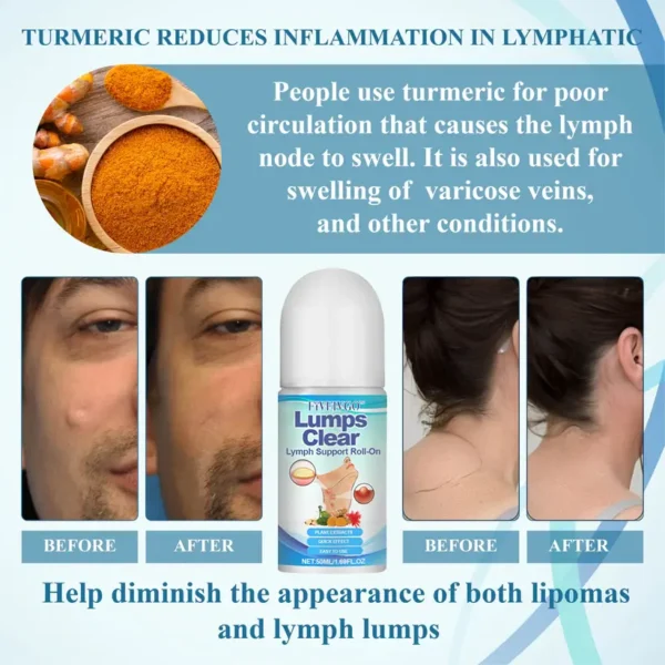 Fivfivgo™ LumpsClear Lymphstütze Roll-On
